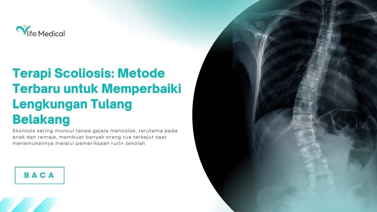 Terapi-Scoliosis-Metode-Terbaru-untuk-Memperbaiki-Lengkungan-Tulang-Belakang.jpg