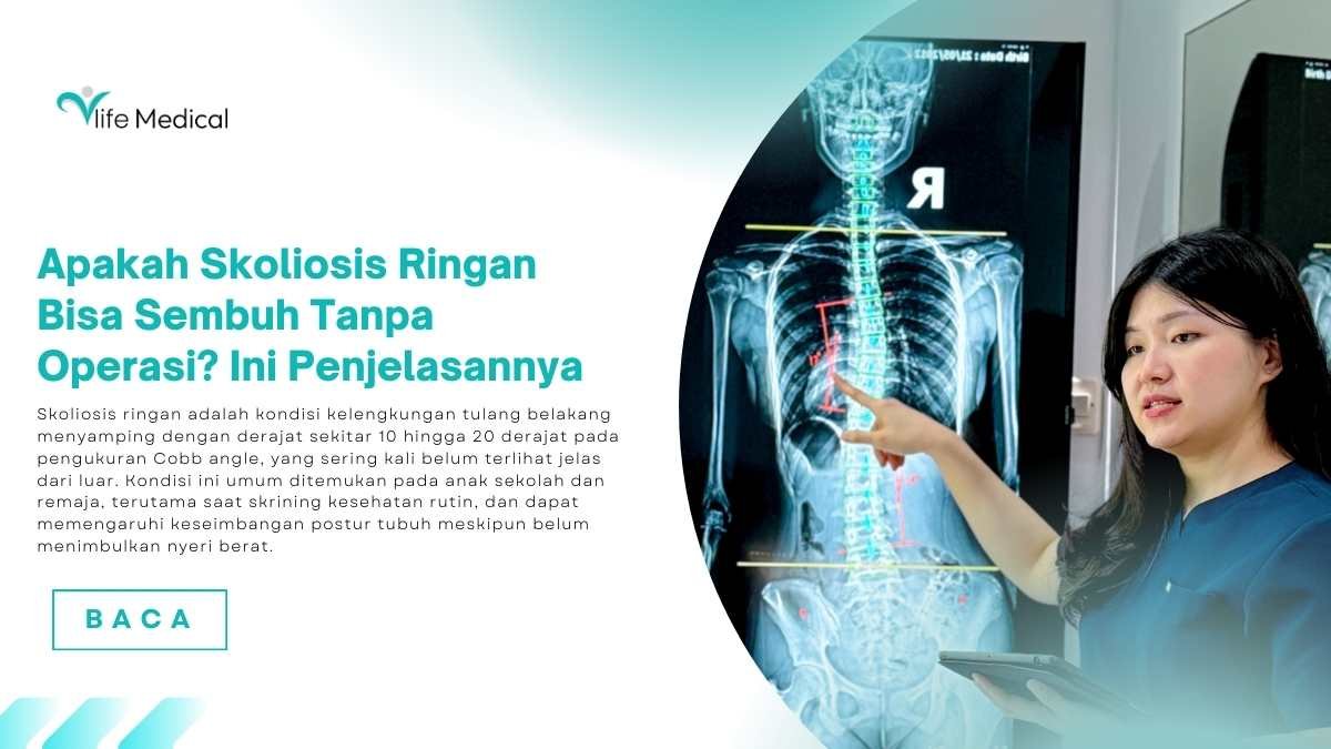 Apakah-Skoliosis-Ringan-Bisa-Sembuh-Tanpa-Operasi-Ini-Penjelasannya.jpg