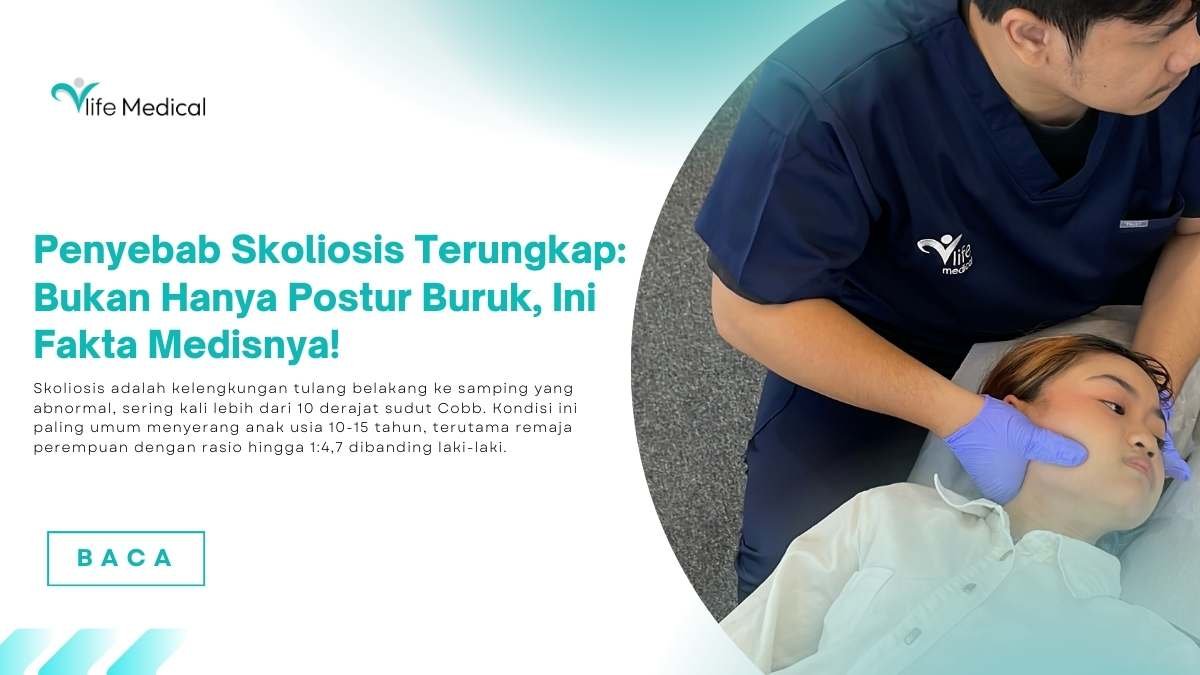 penyebab skoliosis