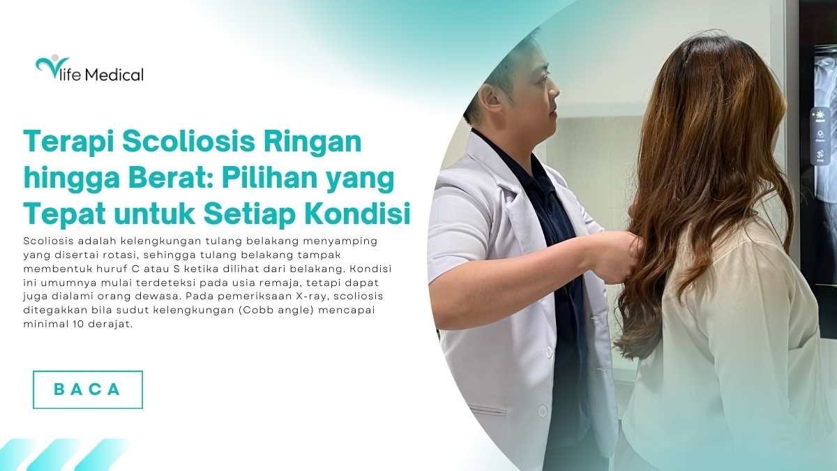 Terapi-Scoliosis-Ringan-hingga-Berat-Pilihan-yang-Tepat-untuk-Setiap-Kondisi.jpg