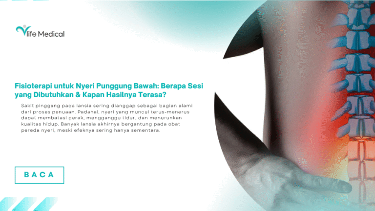 Fisioterapi untuk Nyeri Punggung Bawah: Berapa Sesi yang Dibutuhkan & Kapan Hasilnya Terasa?