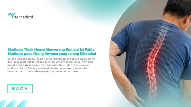 Skoliosis Tidak Hanya Menyerang Remaja! Ini Fakta Skoliosis pada Orang Dewasa yang Jarang Diketahui