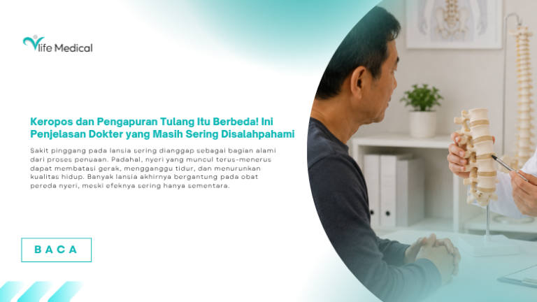 Keropos Tulang dan Pengapuran Itu Berbeda! Jangan Salah Kaprah, Ini Penjelasan yang Perlu Anda Tahu