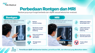 MRI saraf kejepit