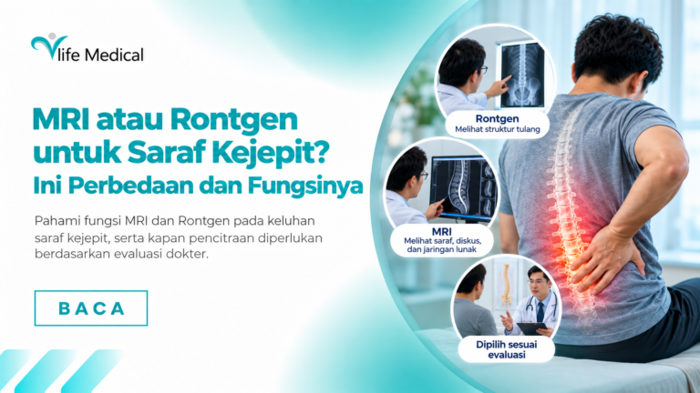 MRI atau Rontgen untuk Saraf Kejepit? Ini Perbedaan dan Fungsinya