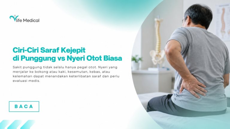 Ciri-Ciri Saraf Kejepit di Punggung vs Nyeri Otot Biasa