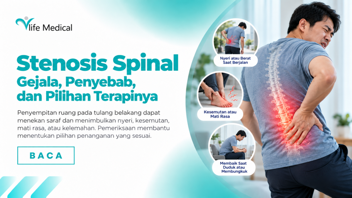 gejala stenosis spinal