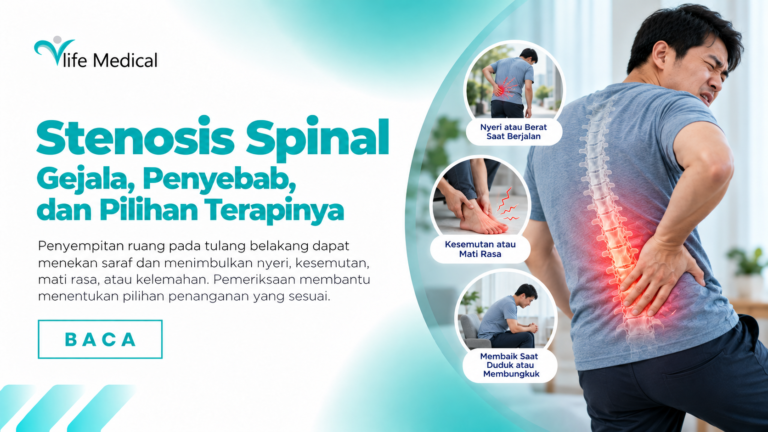 Stenosis Spinal: Gejala, Penyebab, dan Pilihan Terapinya