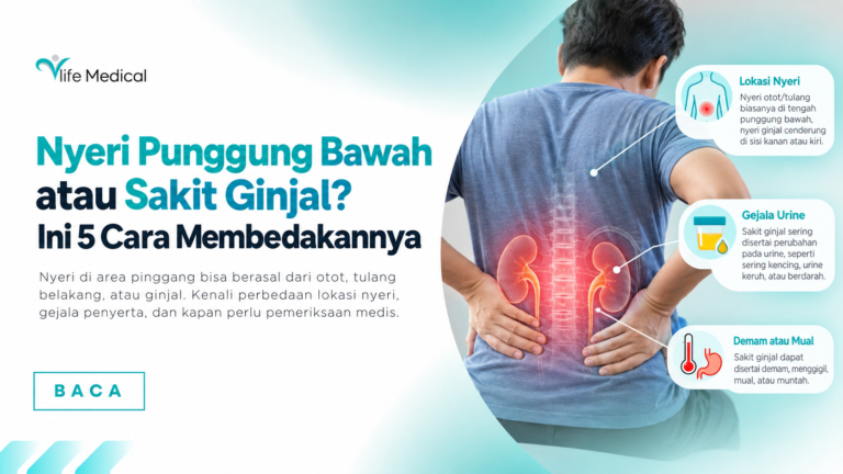 Nyeri Punggung Bawah atau Sakit Ginjal? Ini 5 Cara Membedakannya