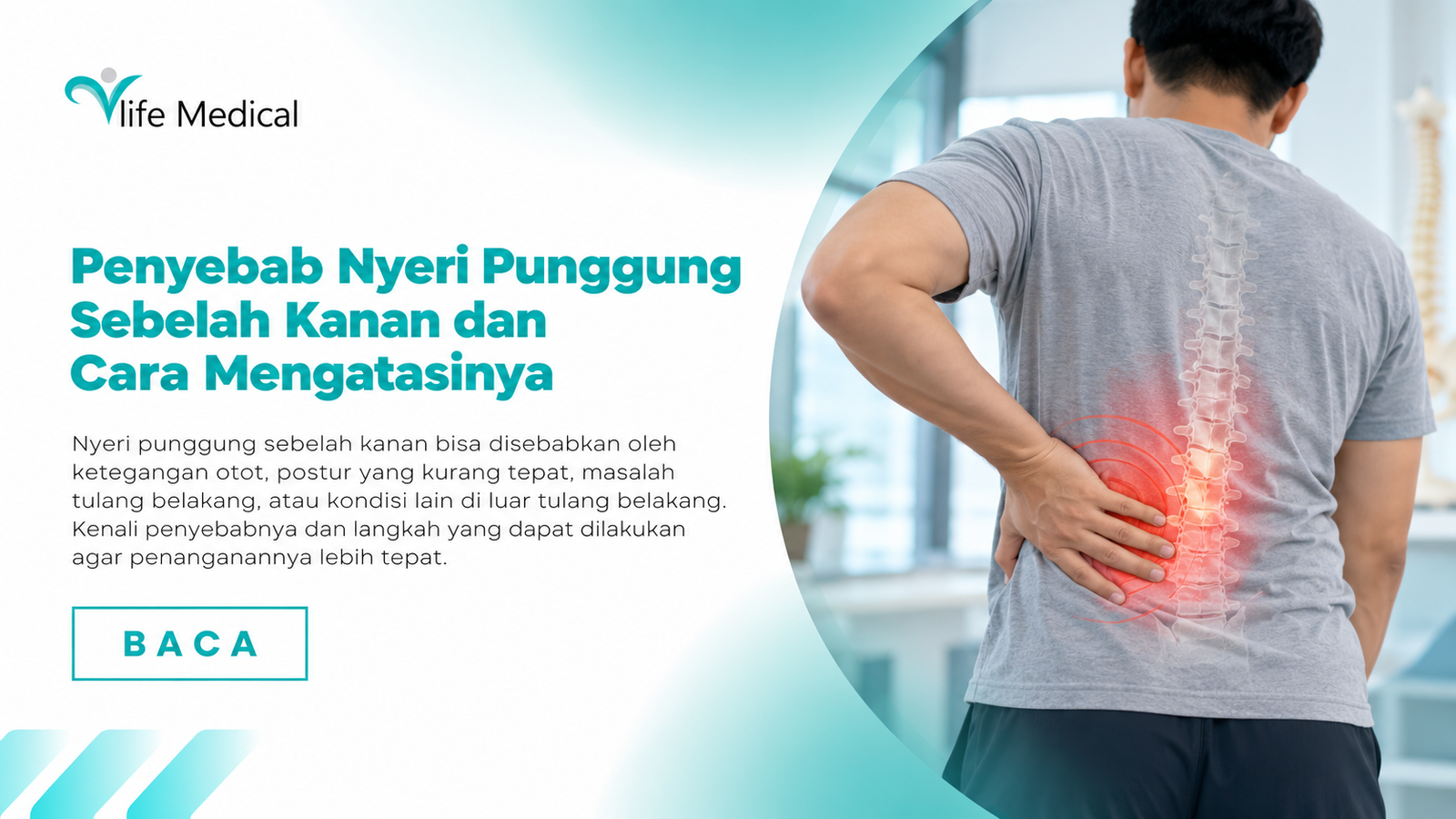 nyeri punggung kanan
